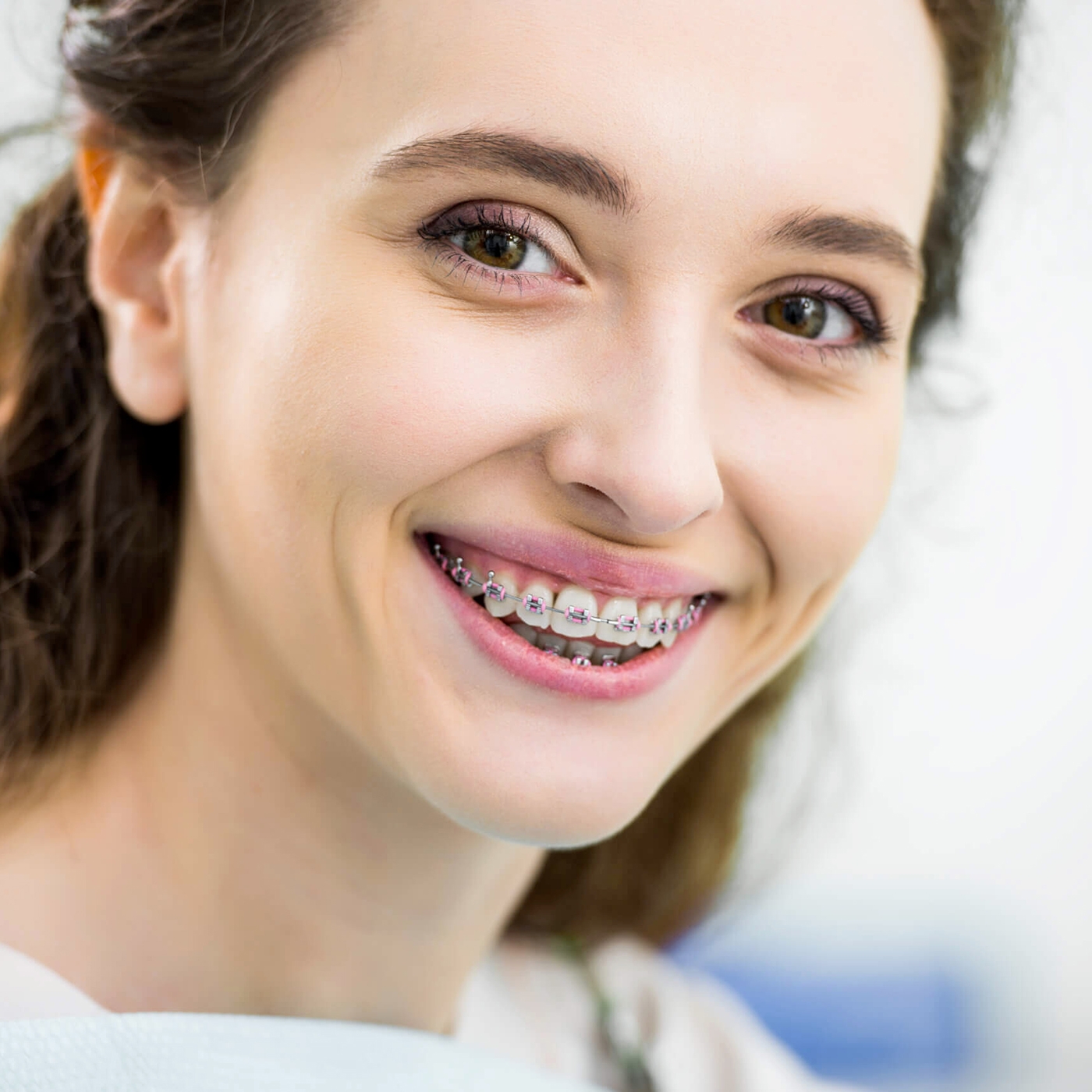 Braces