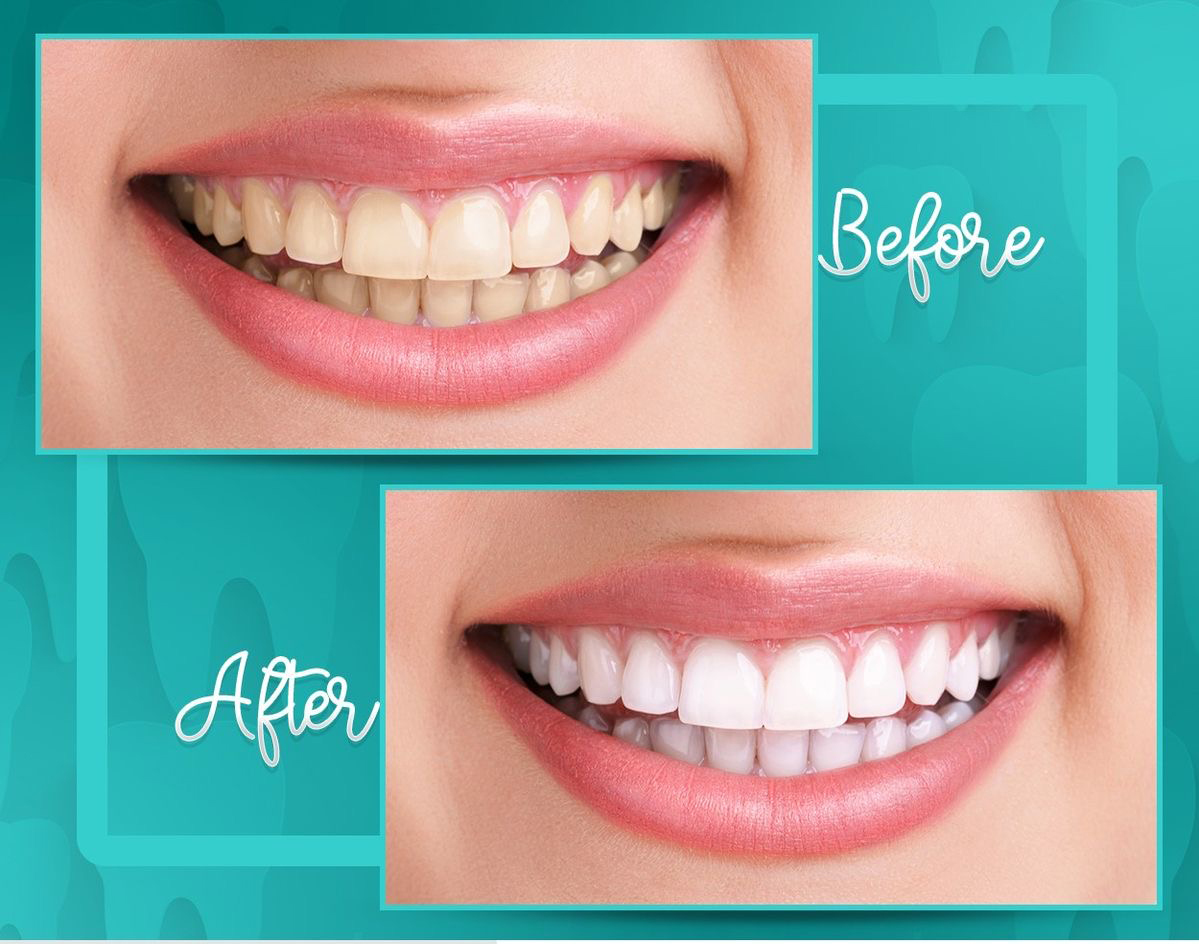 Teeth