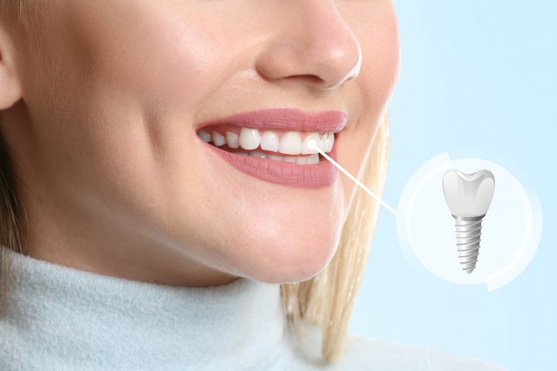images/upload/216649912_implant.jpg