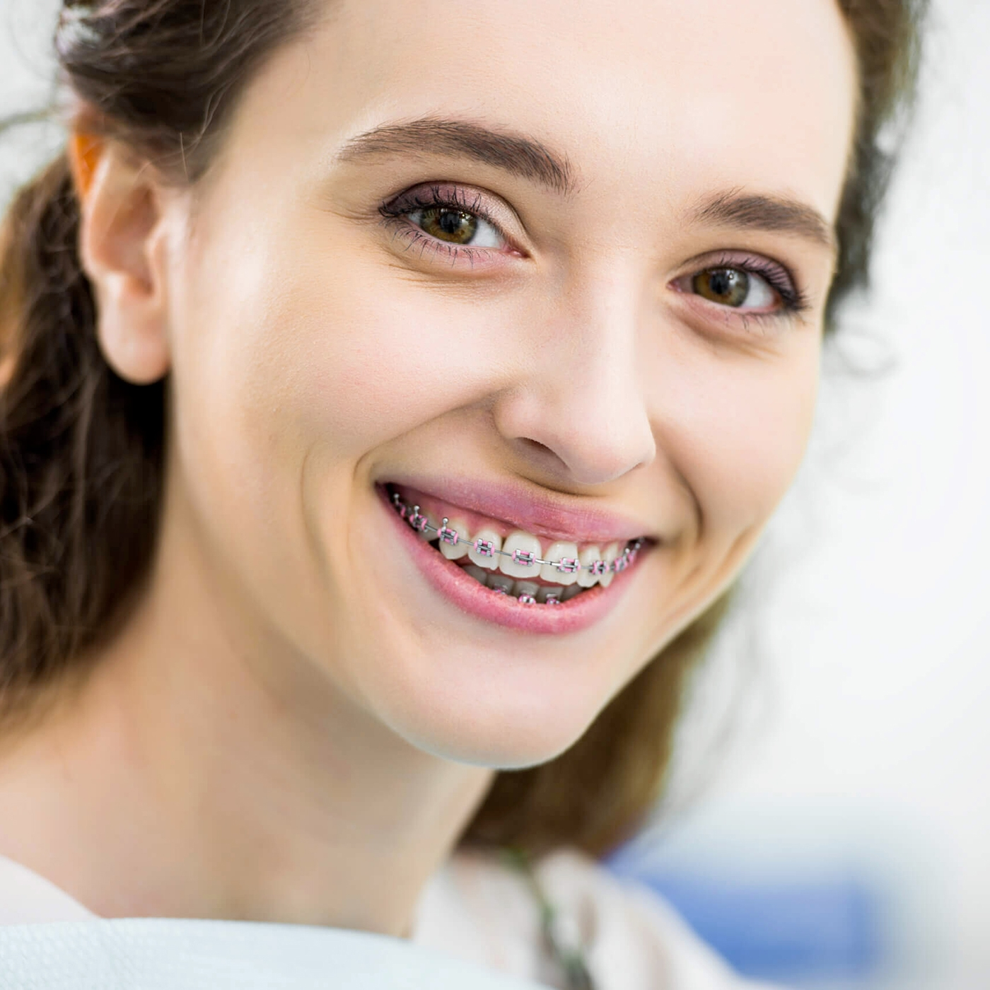 images/upload/1954977108_braces-for-adults-1.webp